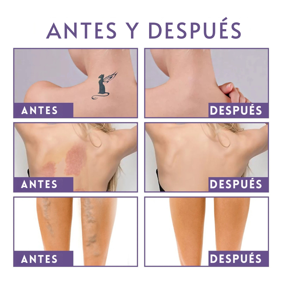 Perfeccionador corporal