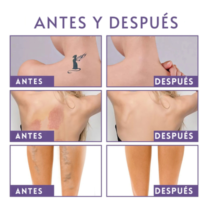 Perfeccionador corporal