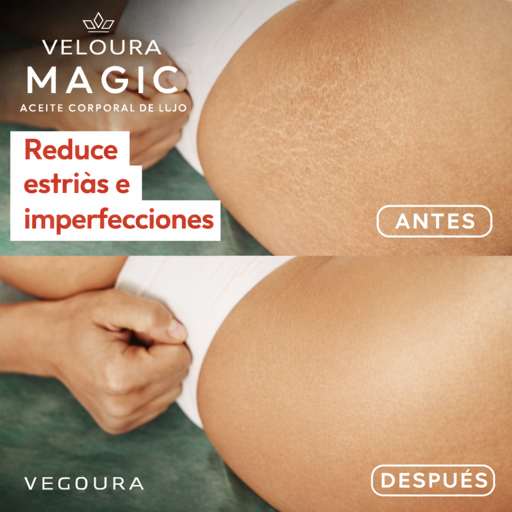 Veloura™ | Mejora la firmeza y suavidad de tu piel en minutos