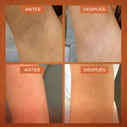Spray Exfoliador - Adiós a las manchas oscuras en 4 semanas